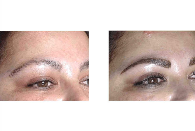 Before and after of eyebrow tattoo.  Left: sparse brows. Right: fuller, darker, shaped brows.