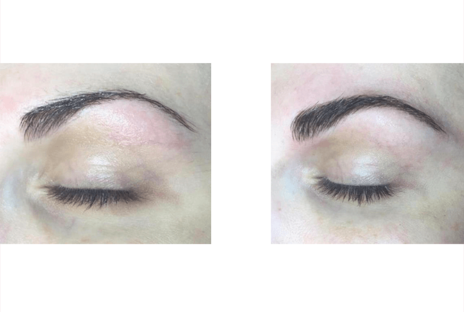 Two close-up photos of eyebrows. Before and after a cosmetic procedure, showing shape and definition.