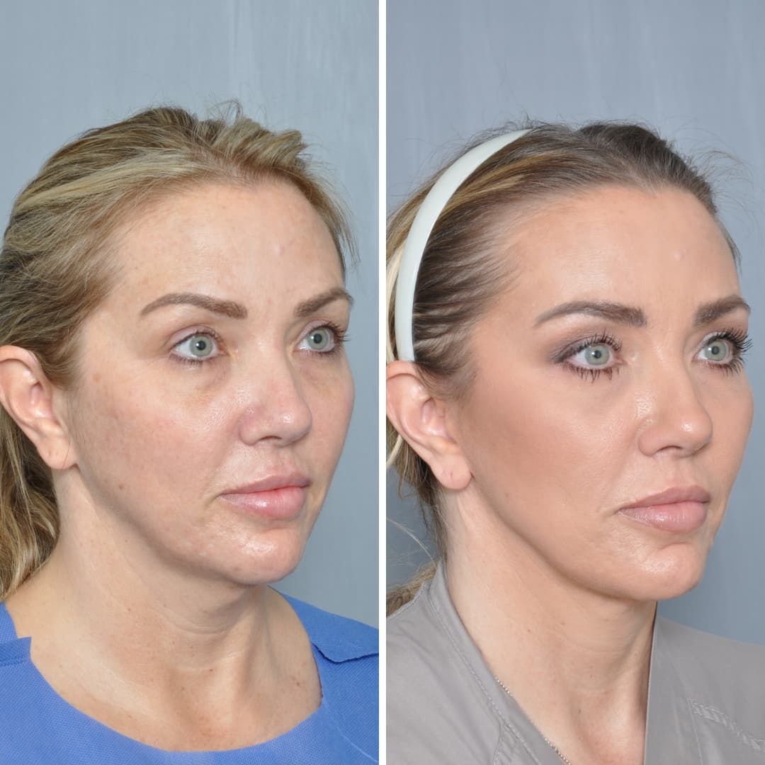 Dr. Jon Perenack - Williamson Cosmetic Center & Perenack Aesthetic Surgery