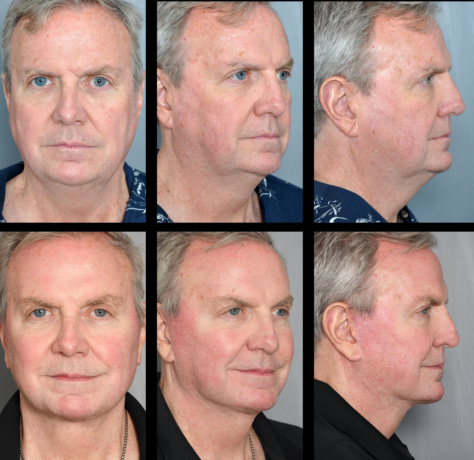 Dr. Jon Perenack - Williamson Cosmetic Center & Perenack Aesthetic Surgery