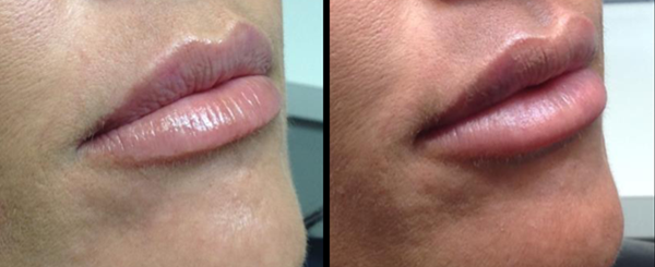 Two side-by-side images of lips; one with a glossy finish, the other more matte.