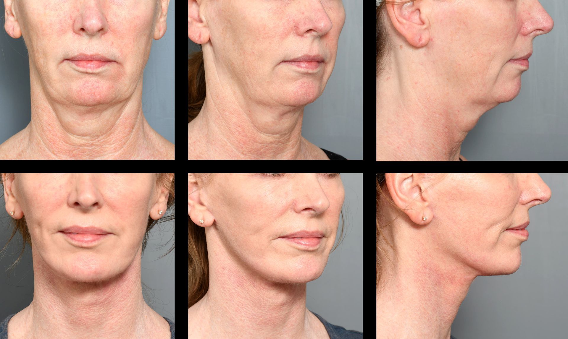 Dr. Jon Perenack - Williamson Cosmetic Center & Perenack Aesthetic Surgery