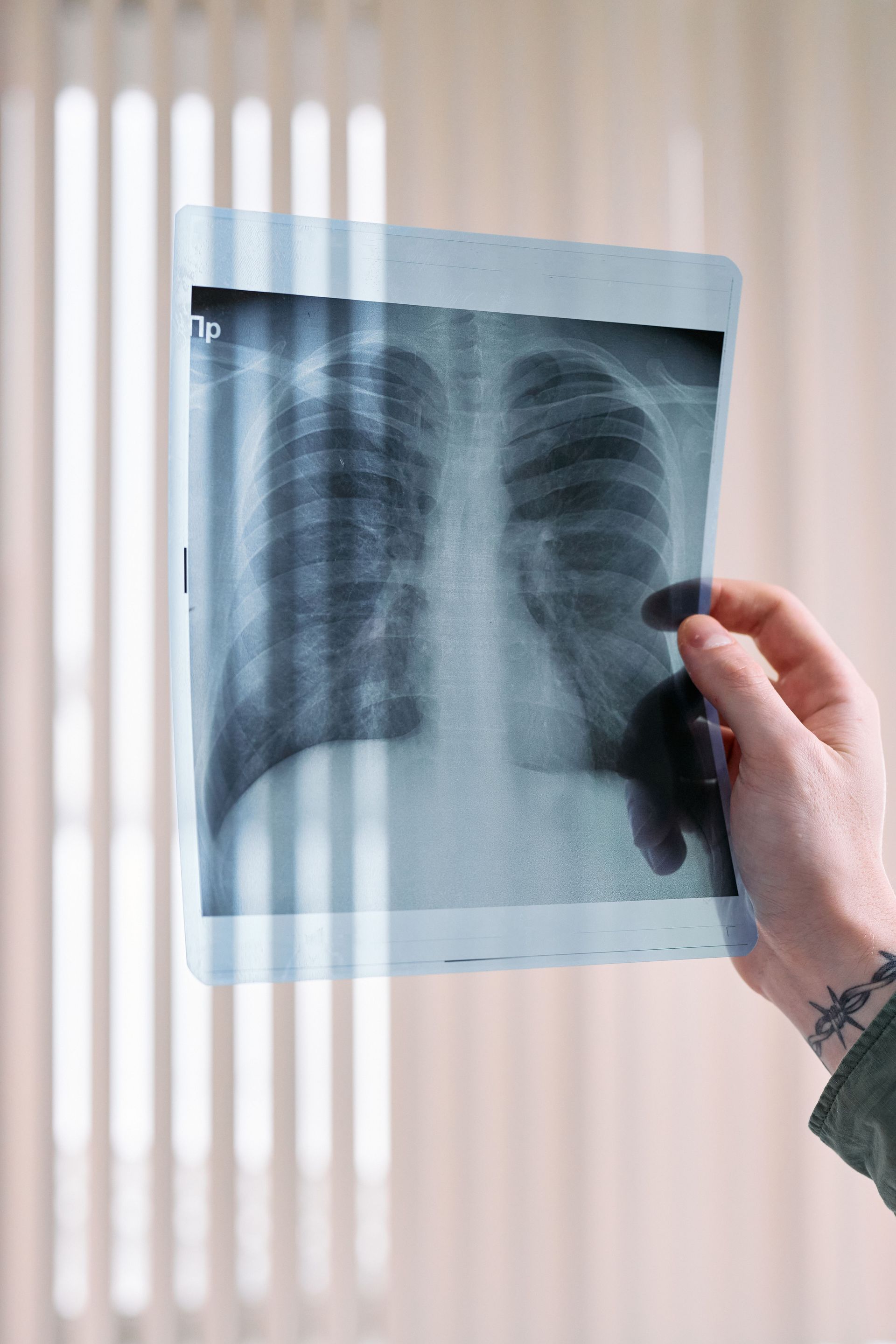 Mano sosteniendo una radiografía de tórax frente a persianas verticales.