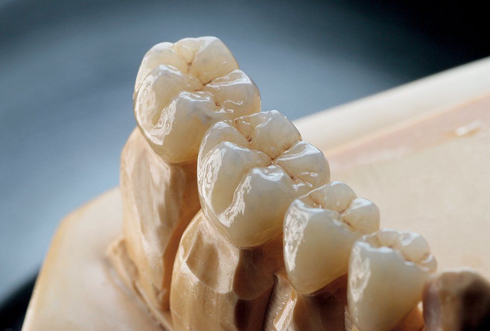 A close up of a model of teeth on a table.