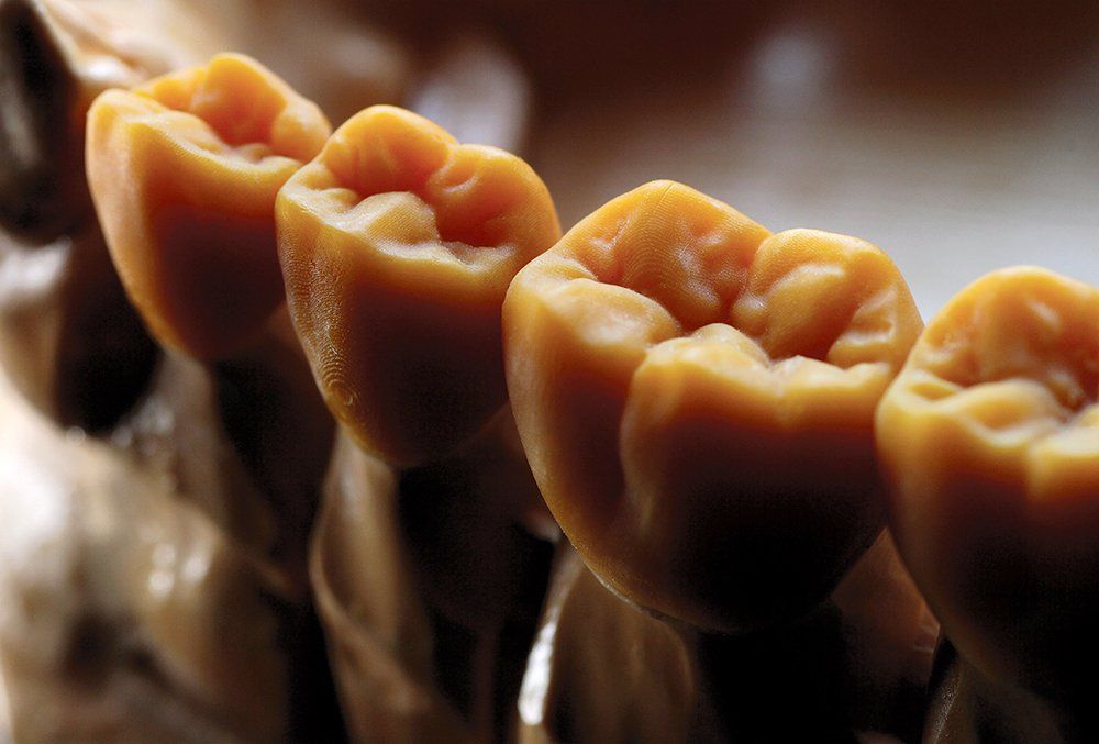 A close up of a row of teeth on a dental model.