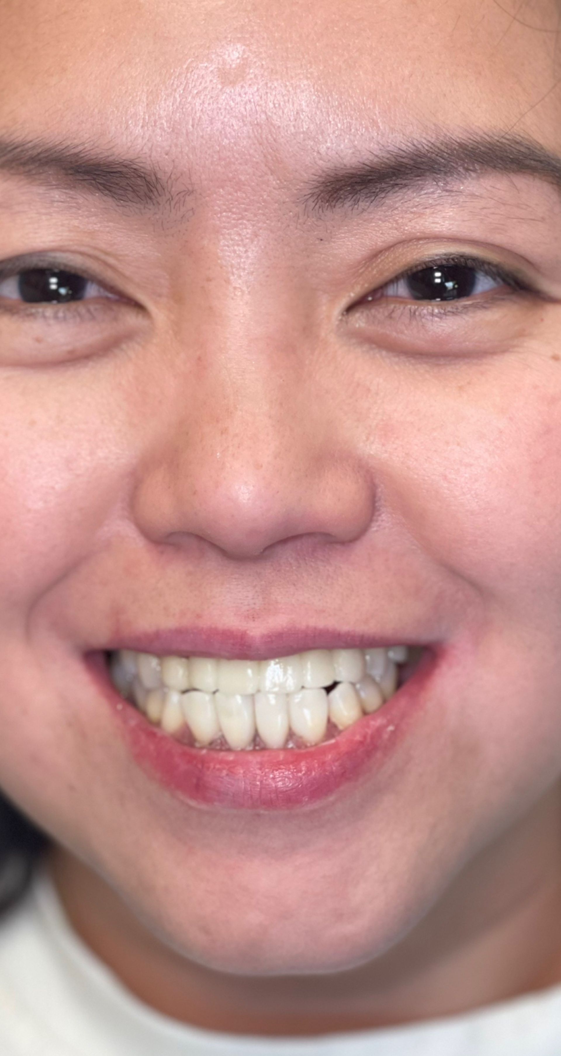 Laser Dental Bakersfield Smile Gallery