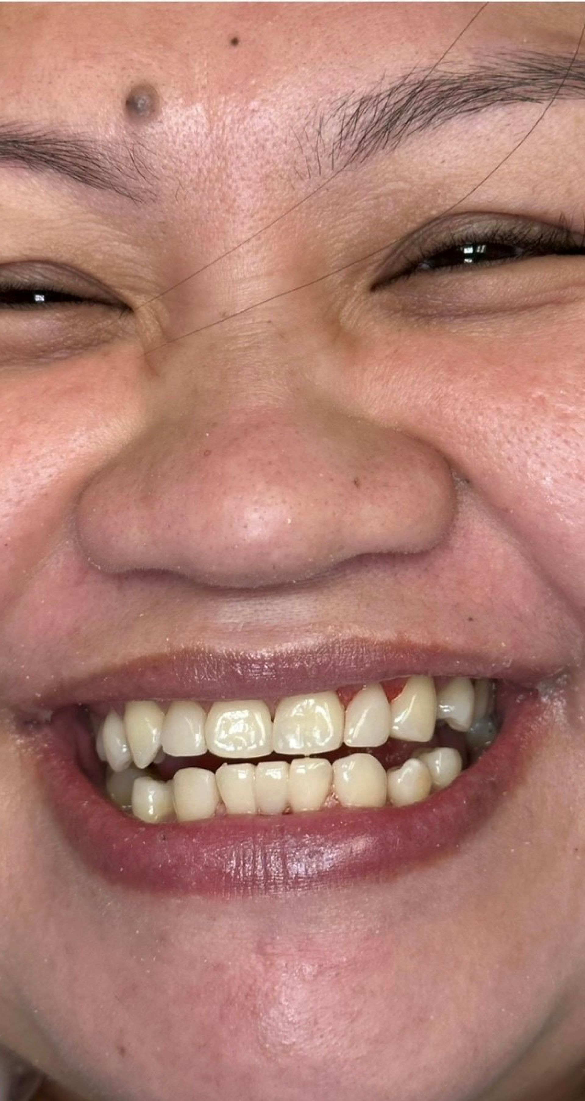 Laser Dental Bakersfield Smile Gallery