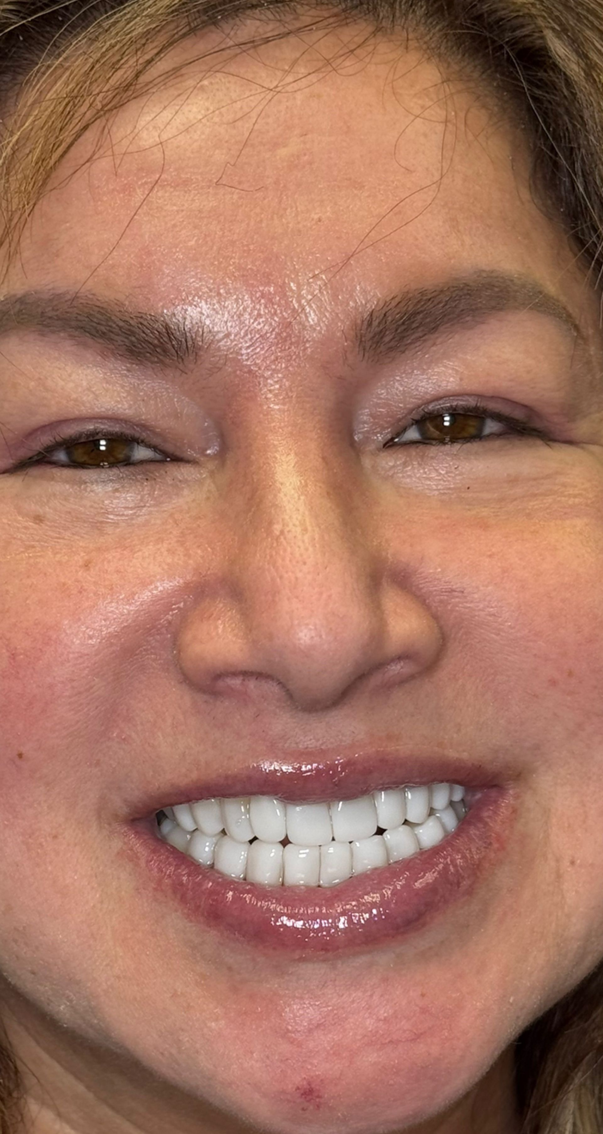 Laser Dental Bakersfield Smile Gallery