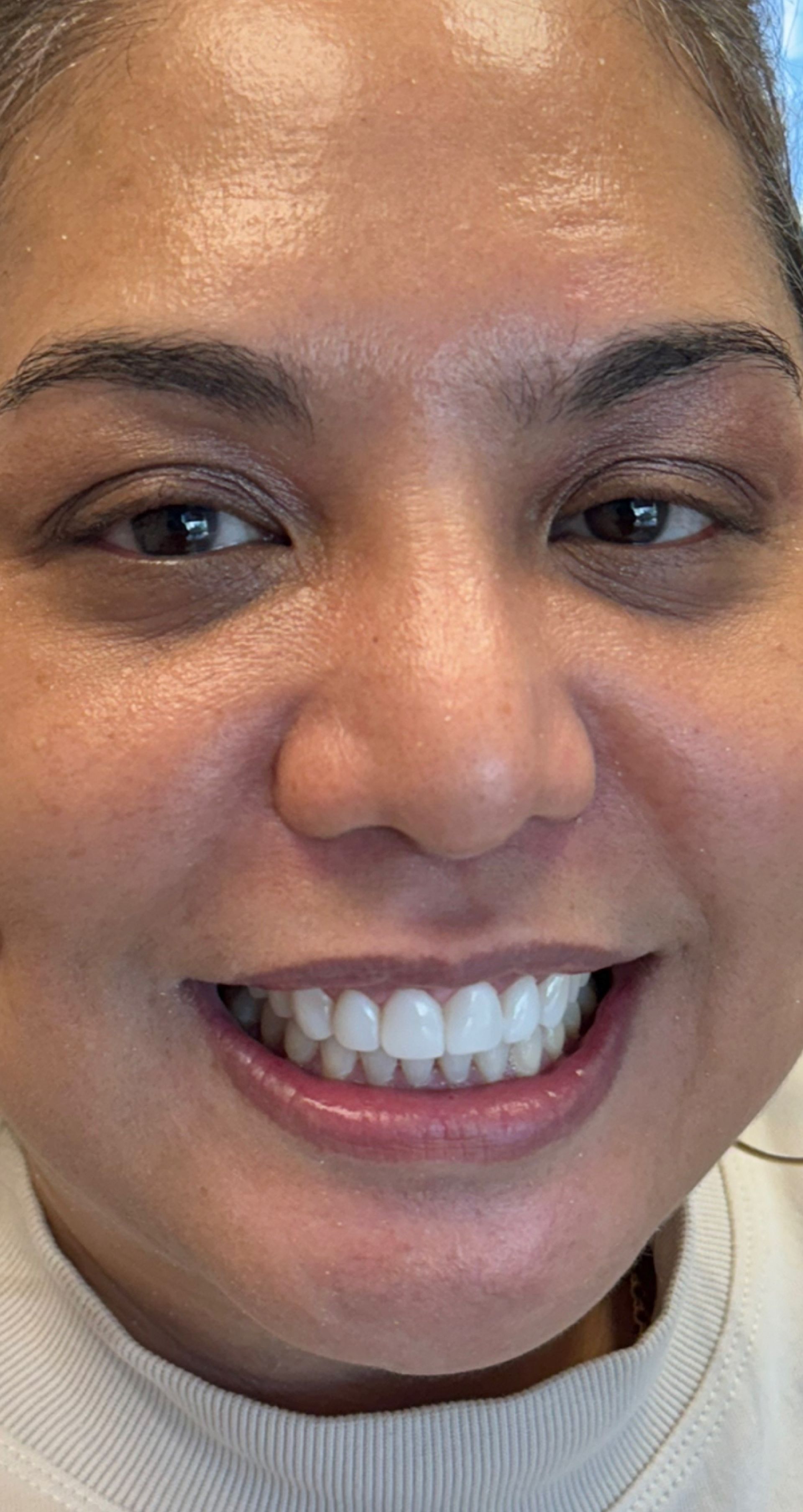 Laser Dental Bakersfield Smile Gallery