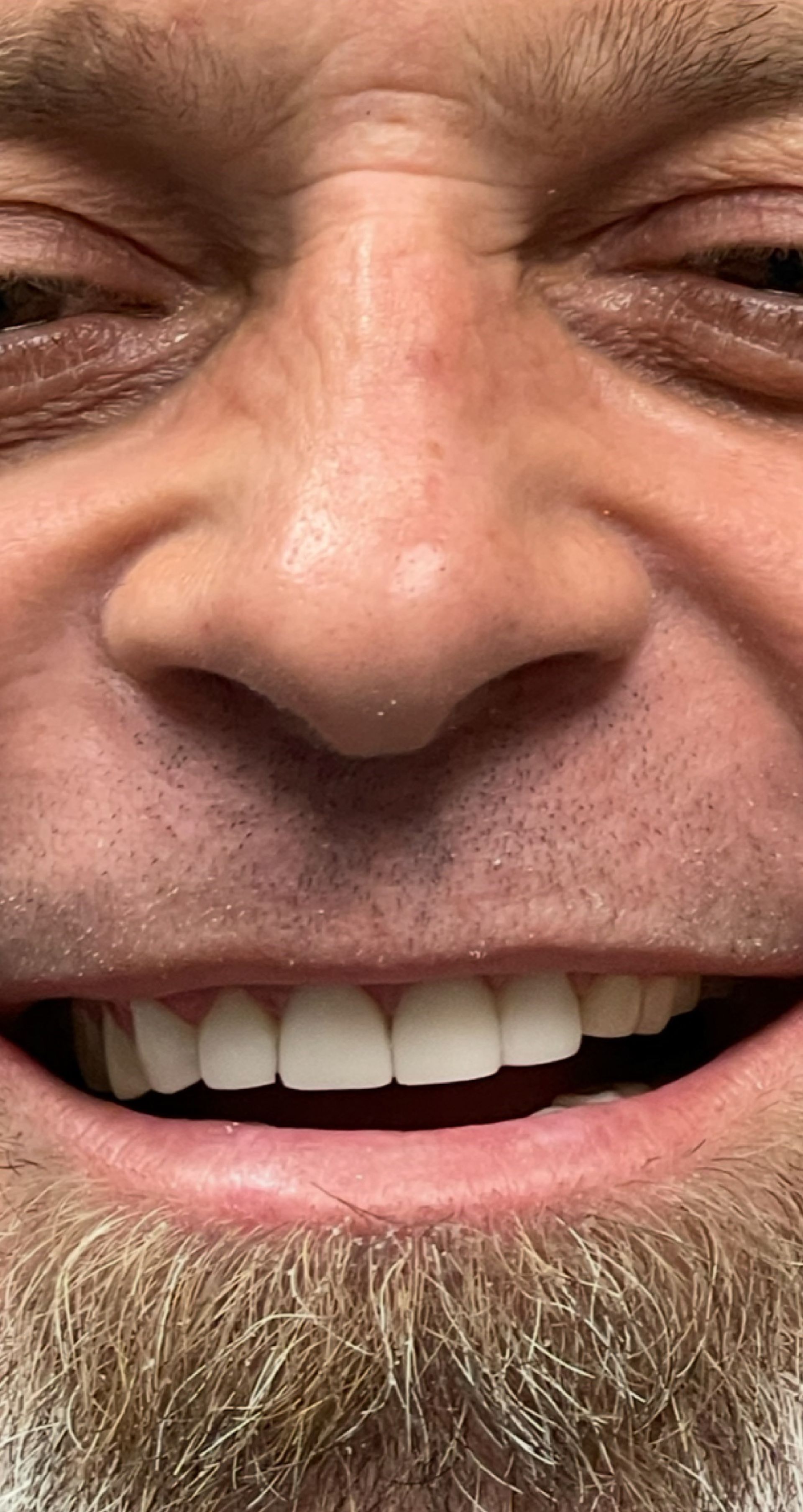 Laser Dental Bakersfield Smile Gallery