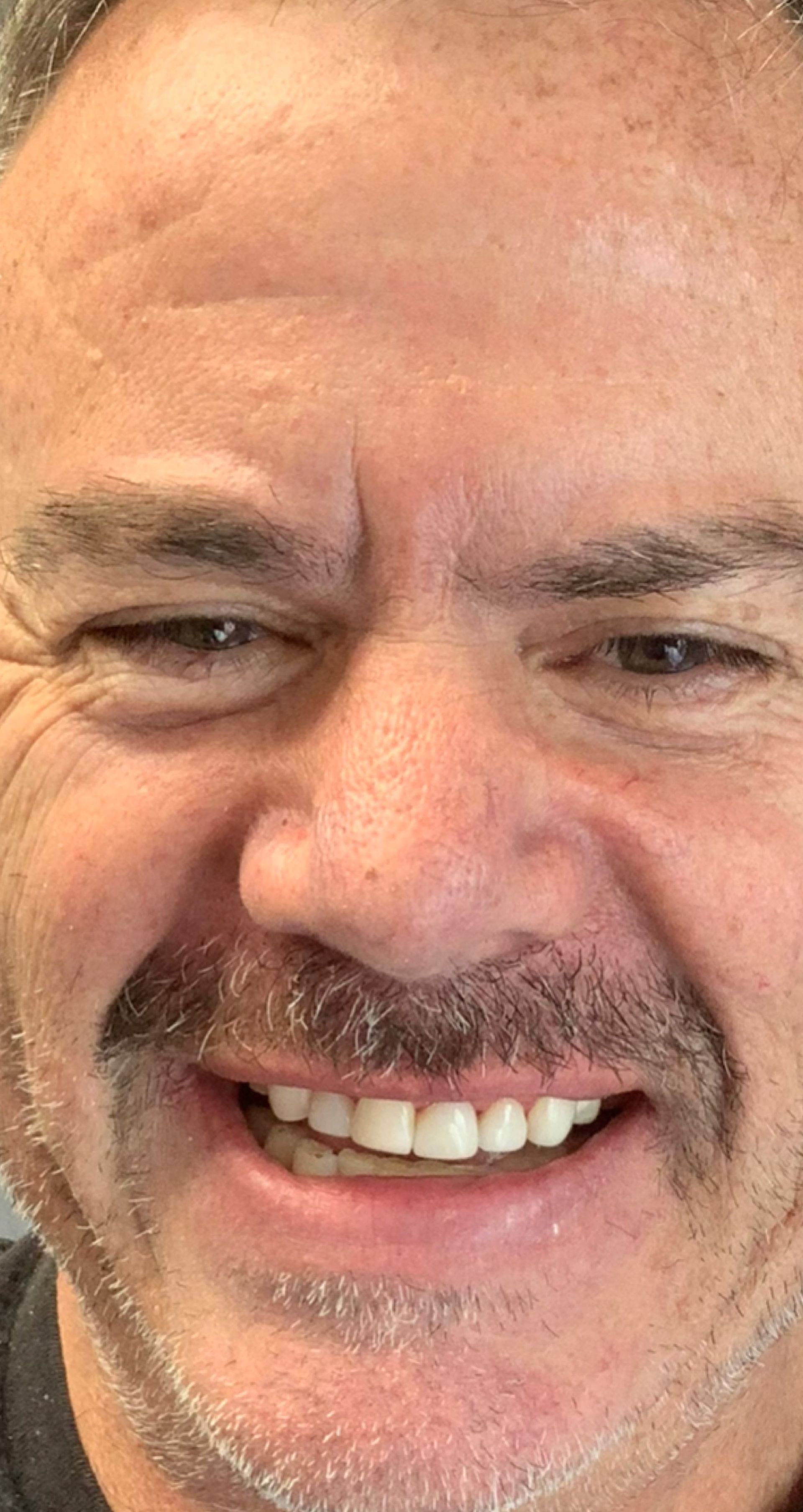 Laser Dental Bakersfield Smile Gallery