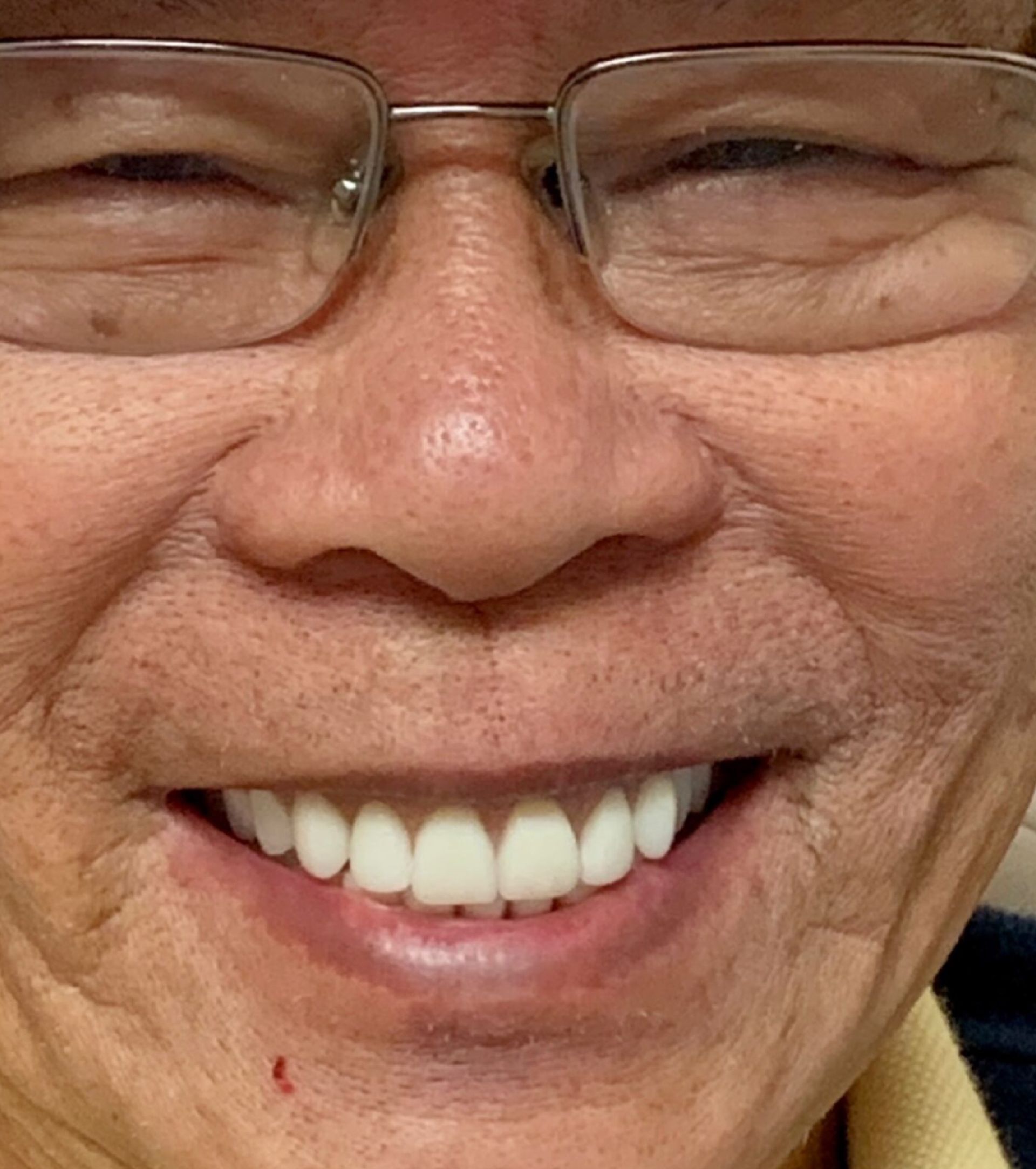 Laser Dental Bakersfield Smile Gallery