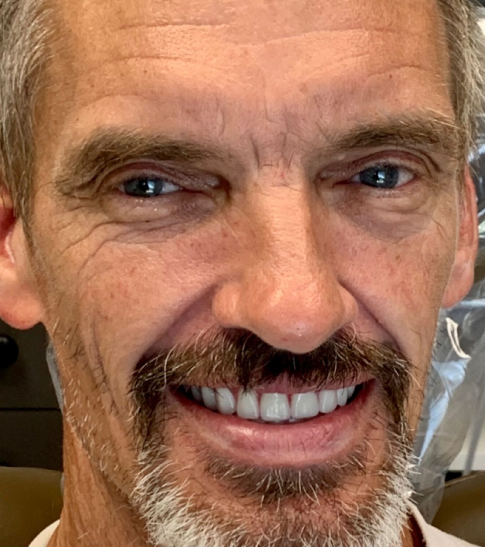 Laser Dental Bakersfield Smile Gallery