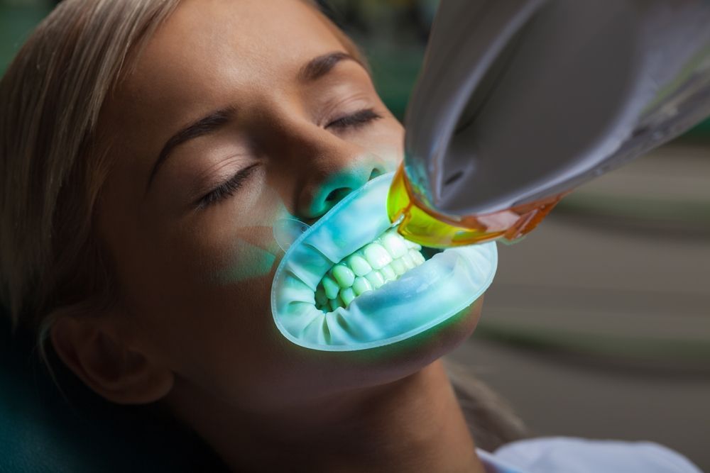 Woman receiving teeth whitening treatment in a dental office. Blue light shines on her mouth with a retractor.