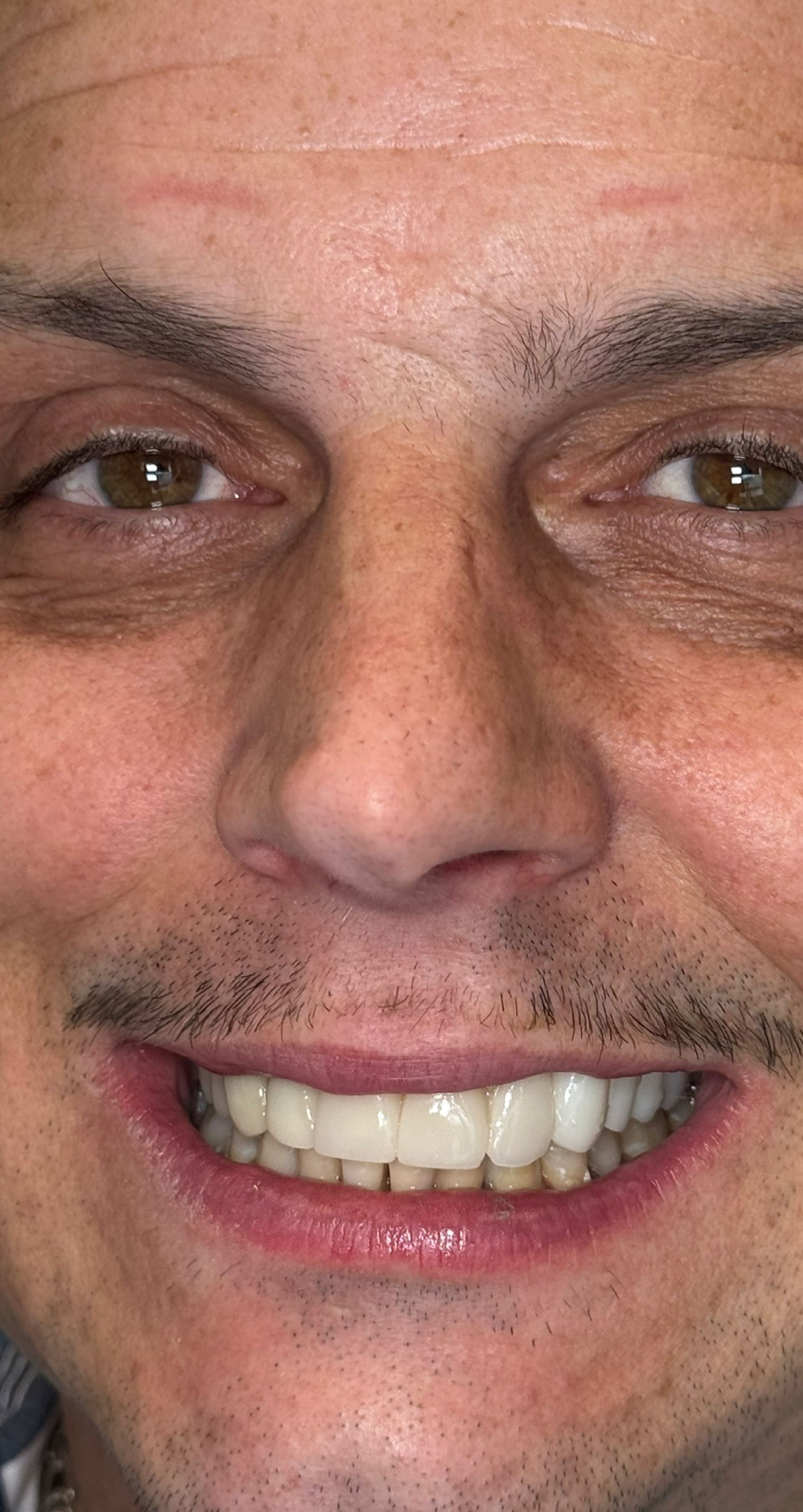 Laser Dental Bakersfield Smile Gallery