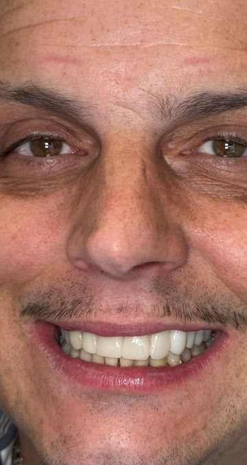 Laser Dental Bakersfield Smile Gallery