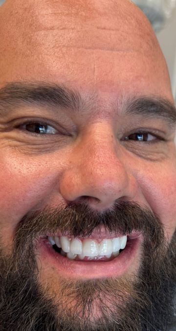 Laser Dental Bakersfield Smile Gallery