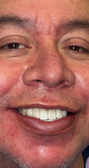 Laser Dental Bakersfield Smile Gallery