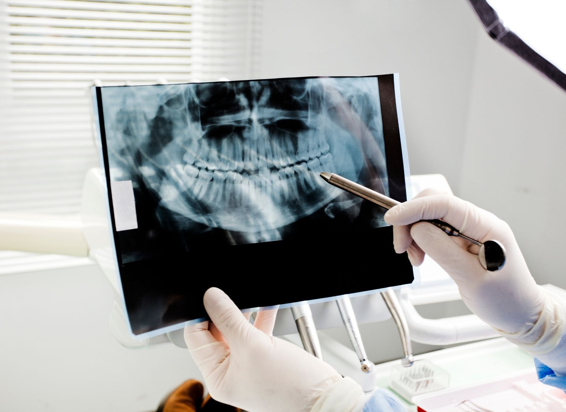 Dentist in gloves points to a panoramic dental X-ray, in a bright office setting.
