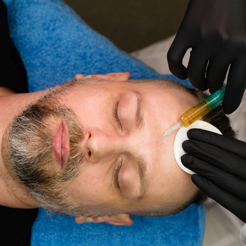 PRP/PRF Facial Rejuvenation treatment at Longevity 360 Med Spa, Newark, Delaware