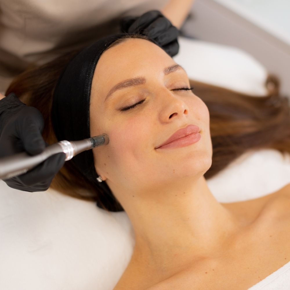 Microneedling at Longevity 360 Med Spa in Newark, Delaware