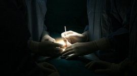 Dettaglio dell'intervento di urologia