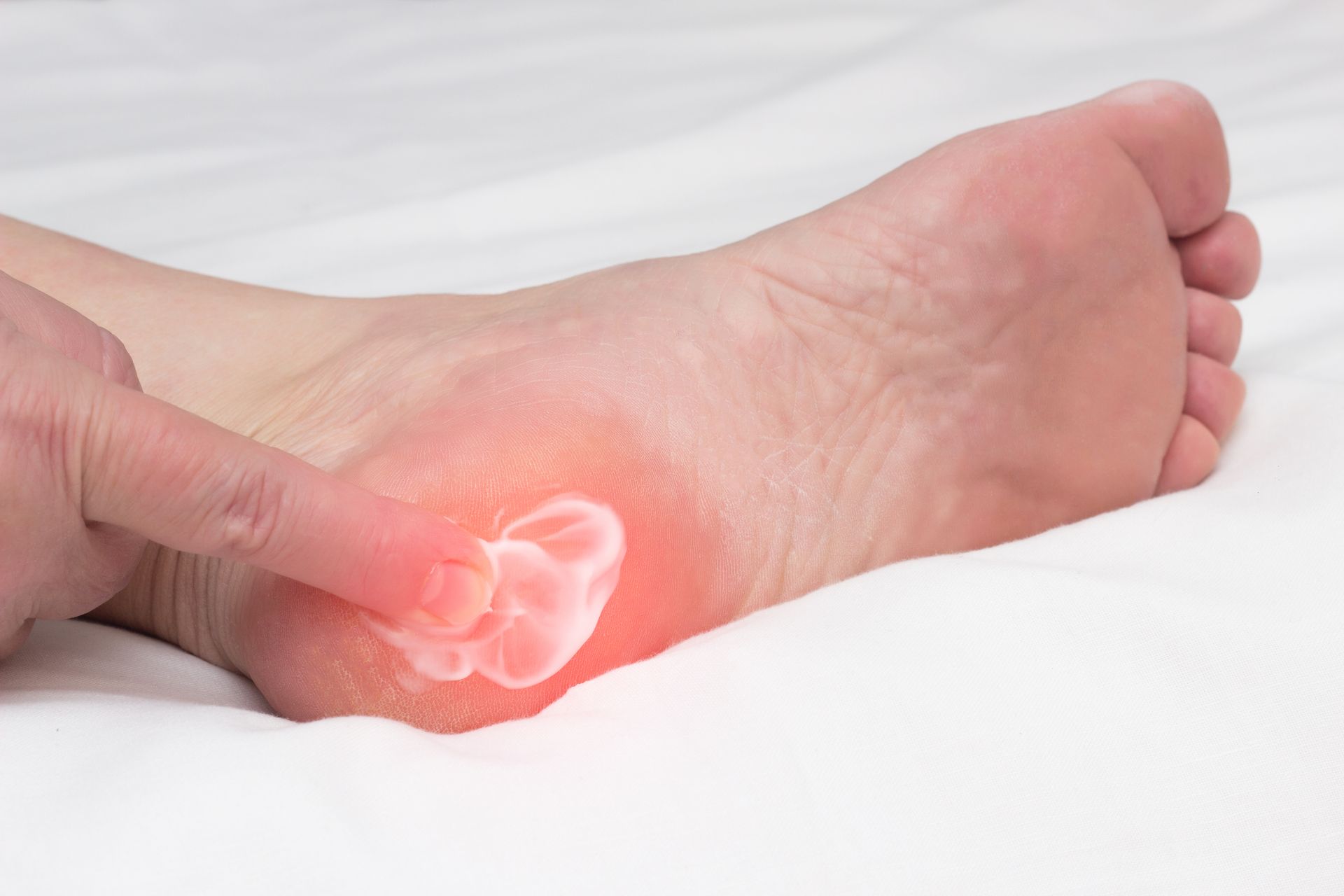 Close-up of heel with highlighted pain area