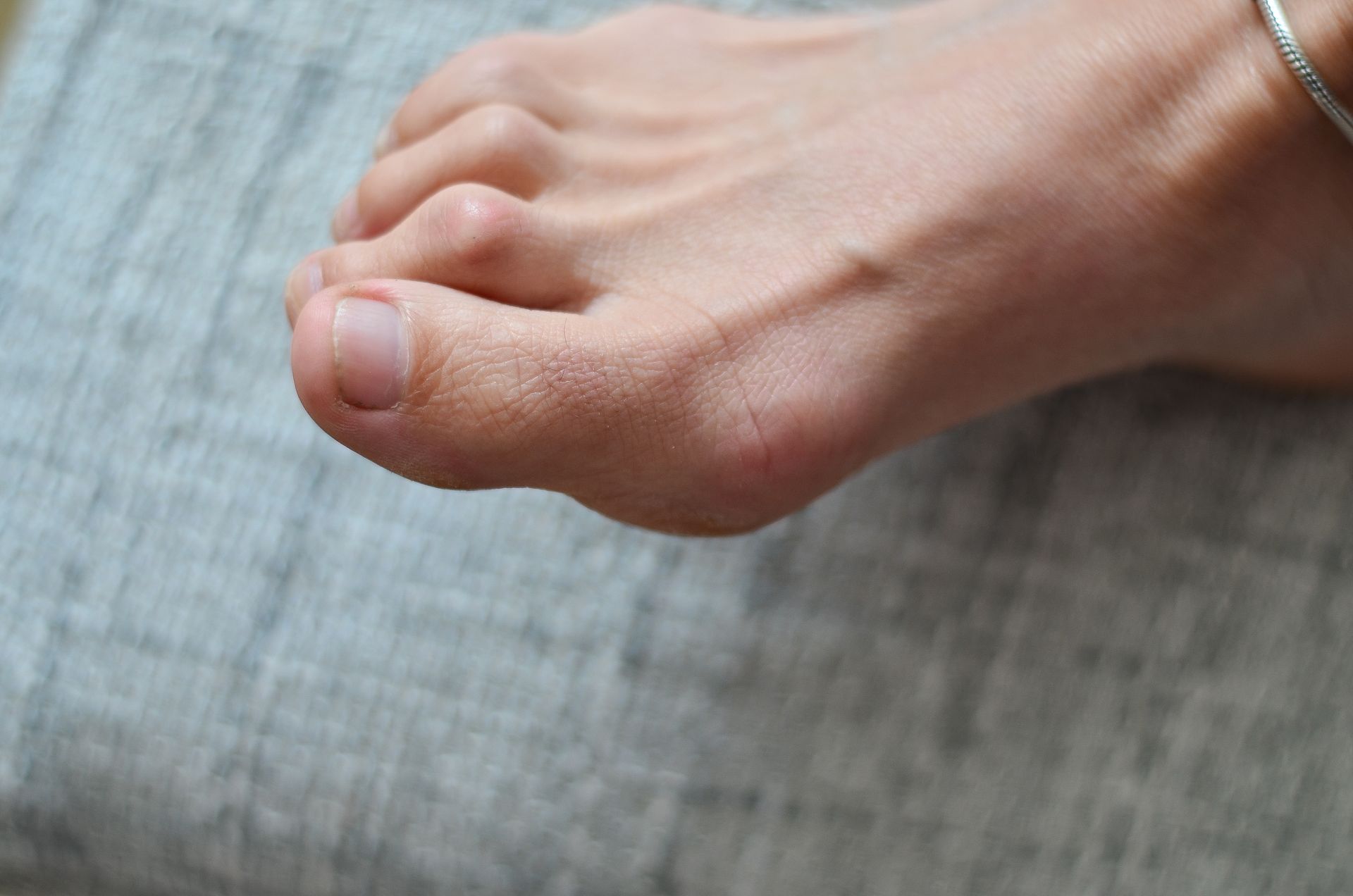 Close-up side view of big toe and forefoot