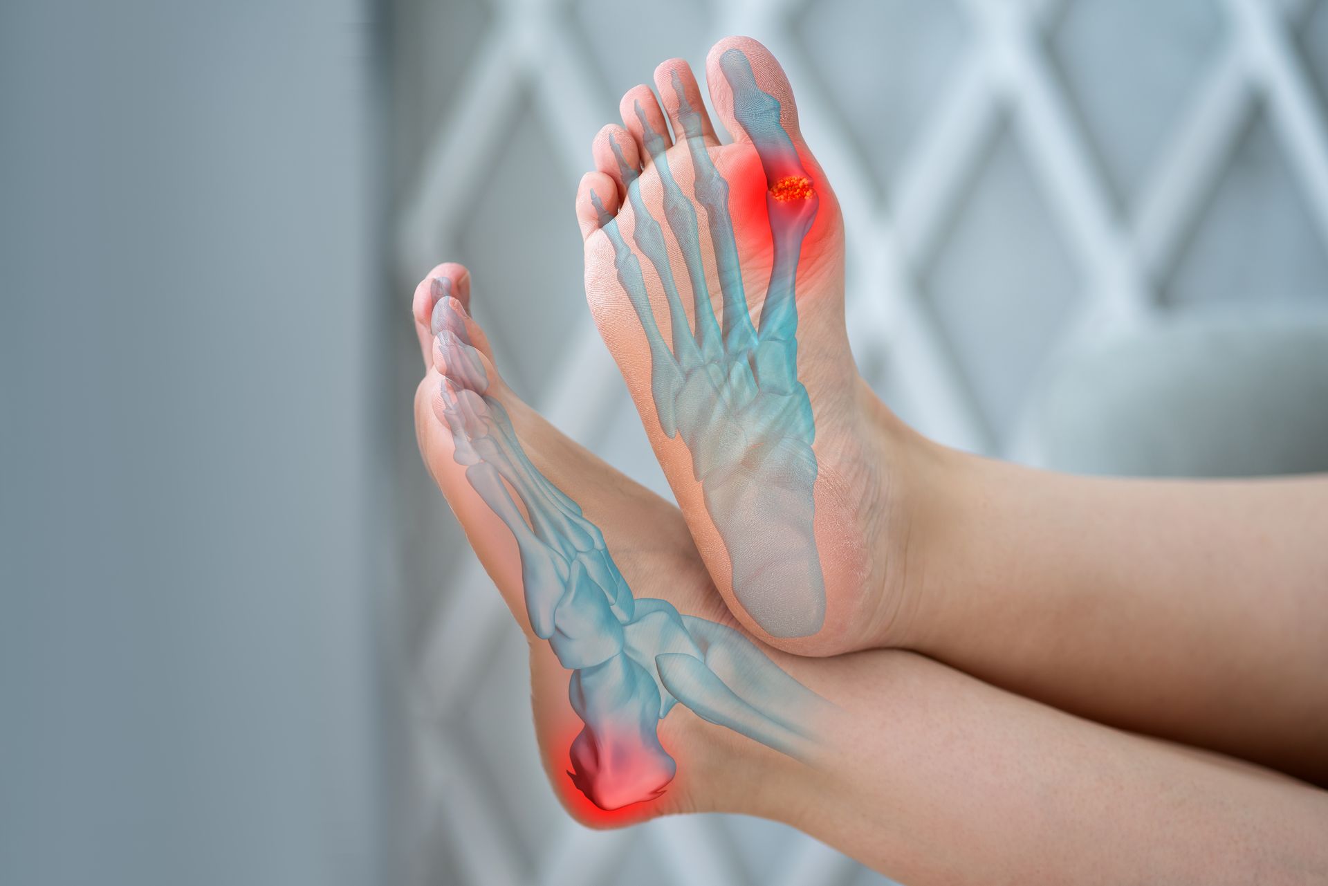 Foot with internal bone structure showing heel pain