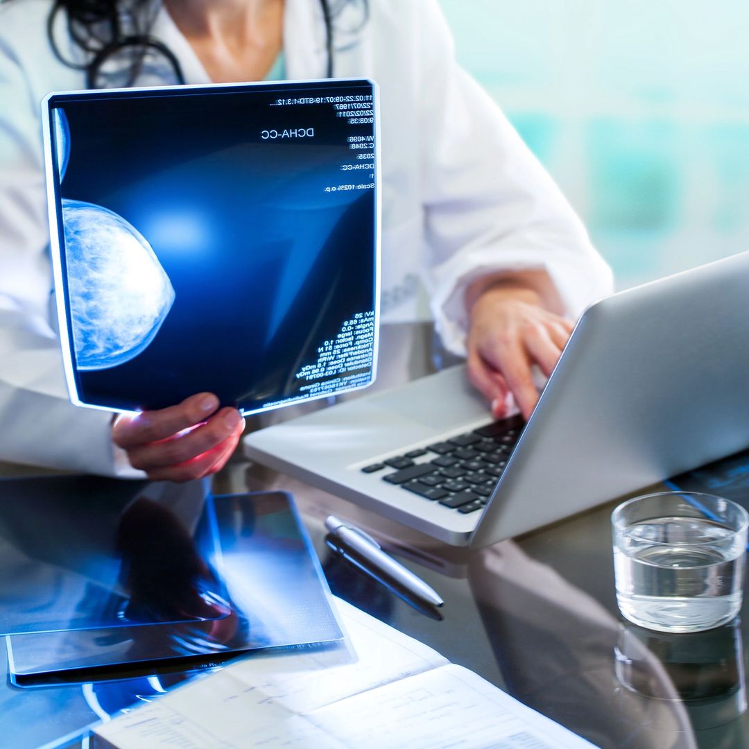 Un operatore sanitario in camice bianco esamina una mammografia utilizzando un computer portatile.