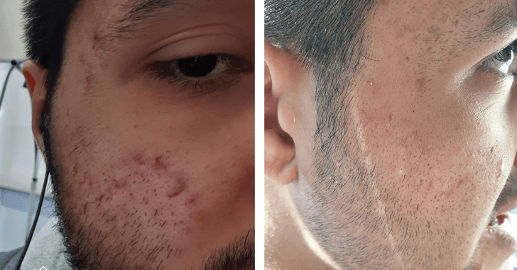 Before and after