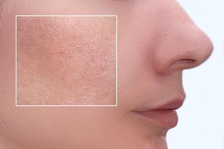 DR. JESÚS HERNÁNDEZ REYES - Médico dermatólogo