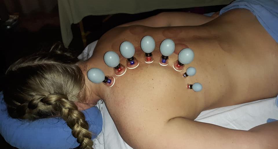 Advanced Cupping-Range of Motion: Sliding