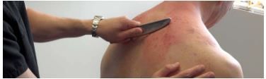 Gua Sha: Tools for the Therapist
