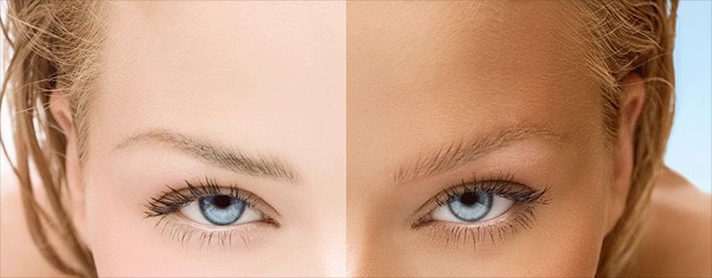 Before And After Tanning Procedure