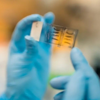 Wearable device targets essential tremor