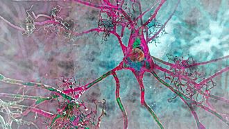 Scientists may have found aging’s hidden trigger for Huntington’s disease