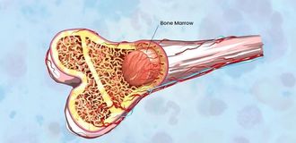 Early trial supports brain delivery of Parkinson’s therapy