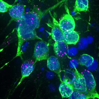 Aspen Neuroscience receives FDA RMAT designation for Parkinson’s candidate