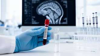 Blood RNA patterns offer clues to essential tremor’s cognitive and brain differences