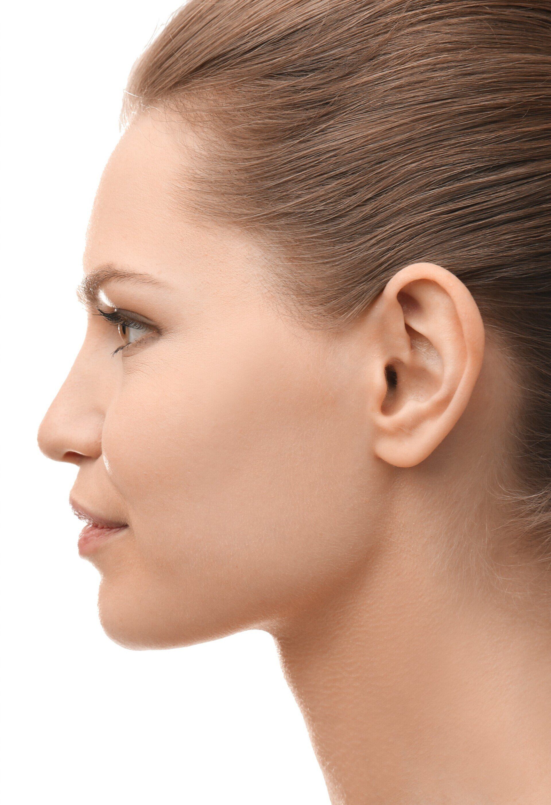 After Rhinoplasty