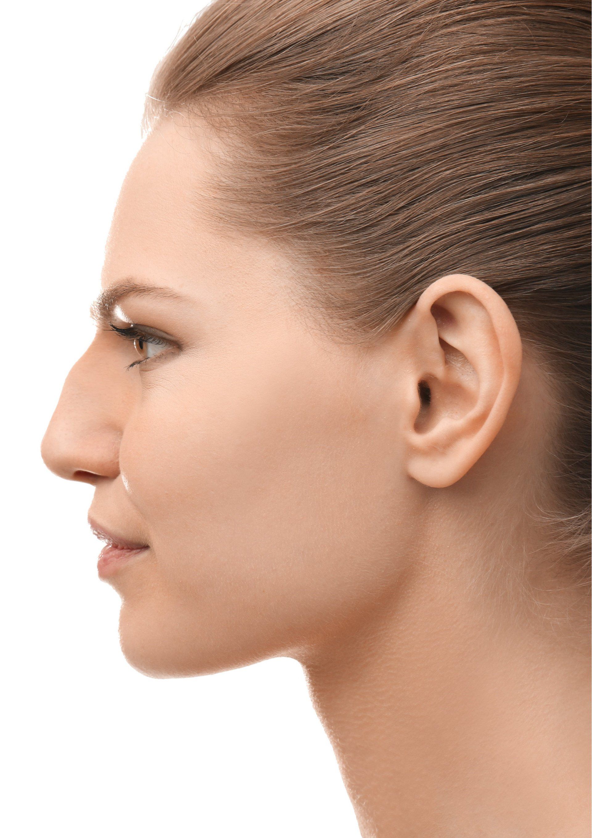 Before Rhinoplasty
