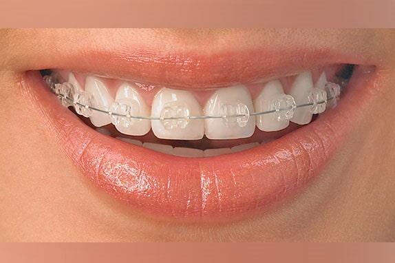 CIRUJANOS DENTISTAS MILITARES