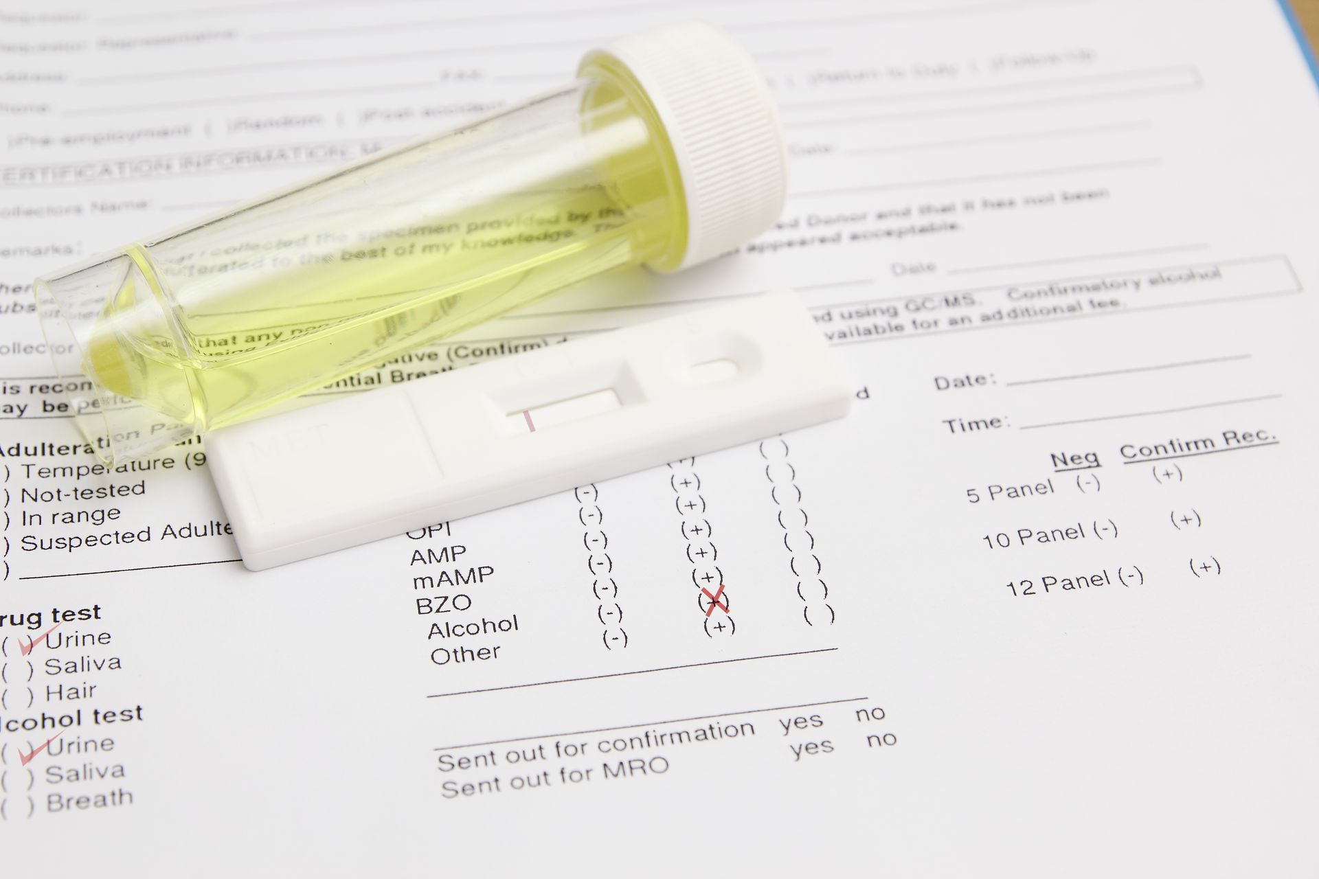 Yellow-tinted specimen vial on medical paperwork with pen and test checklist