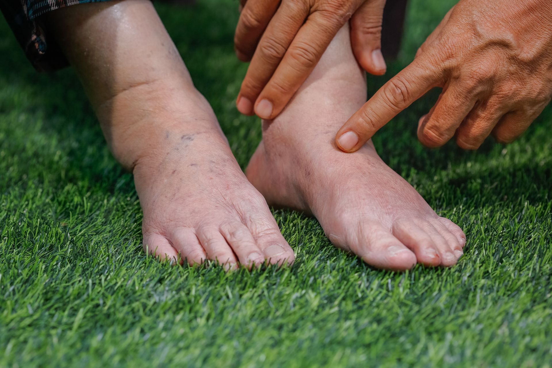 Two bare feet on grass while hands point to toes