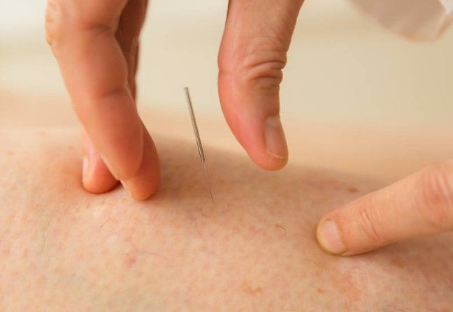 jij staat centraal een acupunctuurbehandeling is uniek en op jou afgestemd