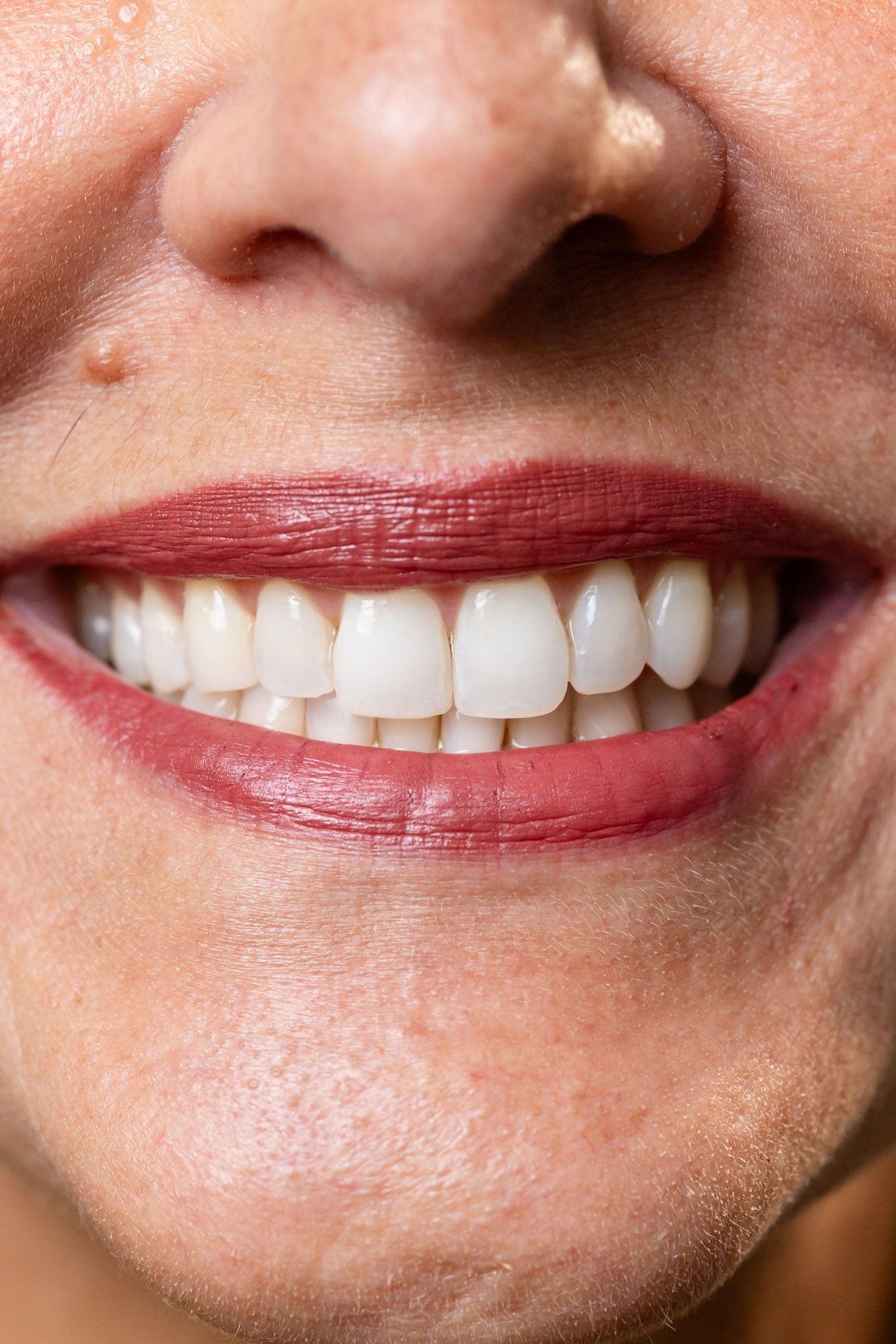 Close-up mouth with pink lipstick and white teeth.