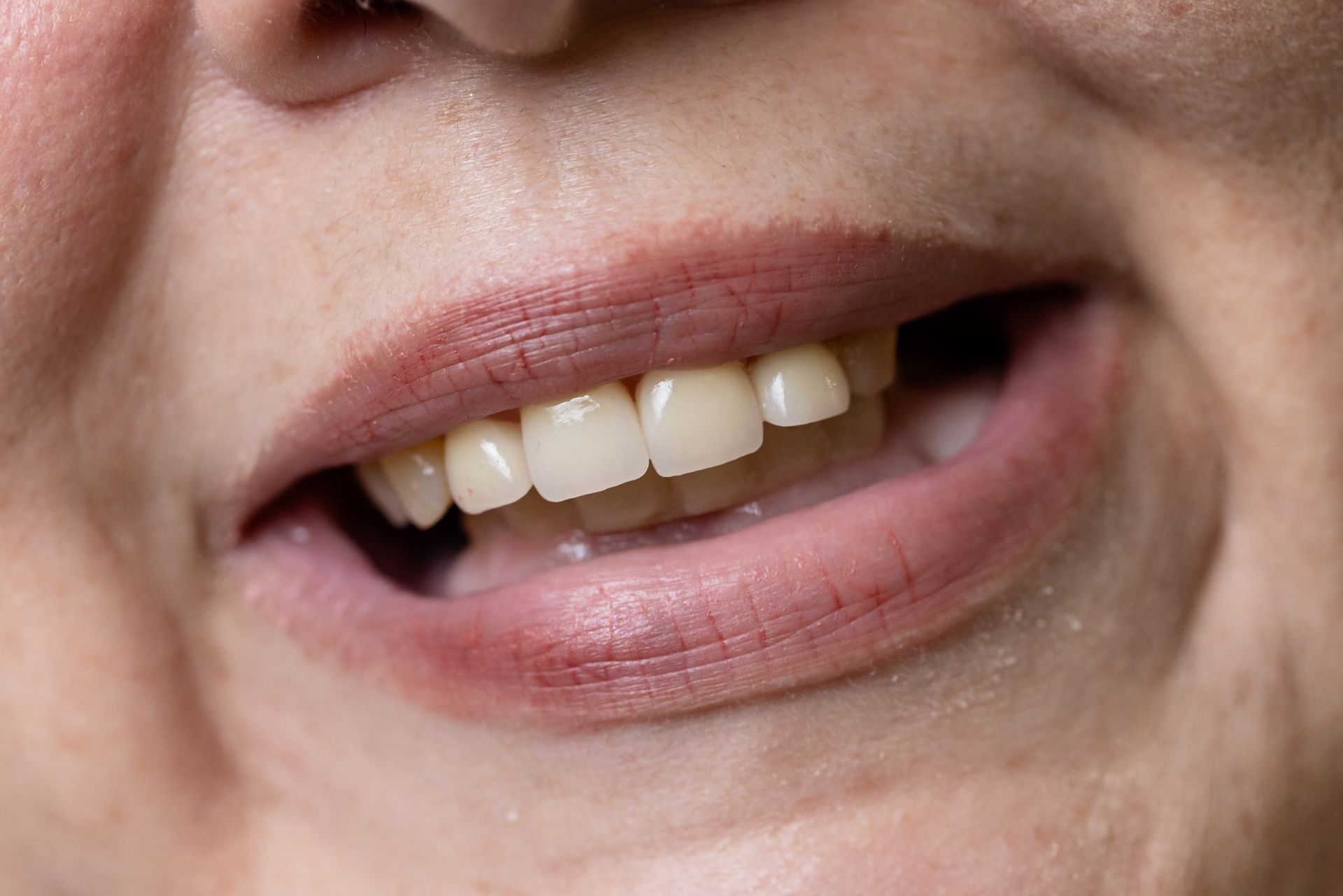 Close-up of a smiling mouth showing teeth and lips