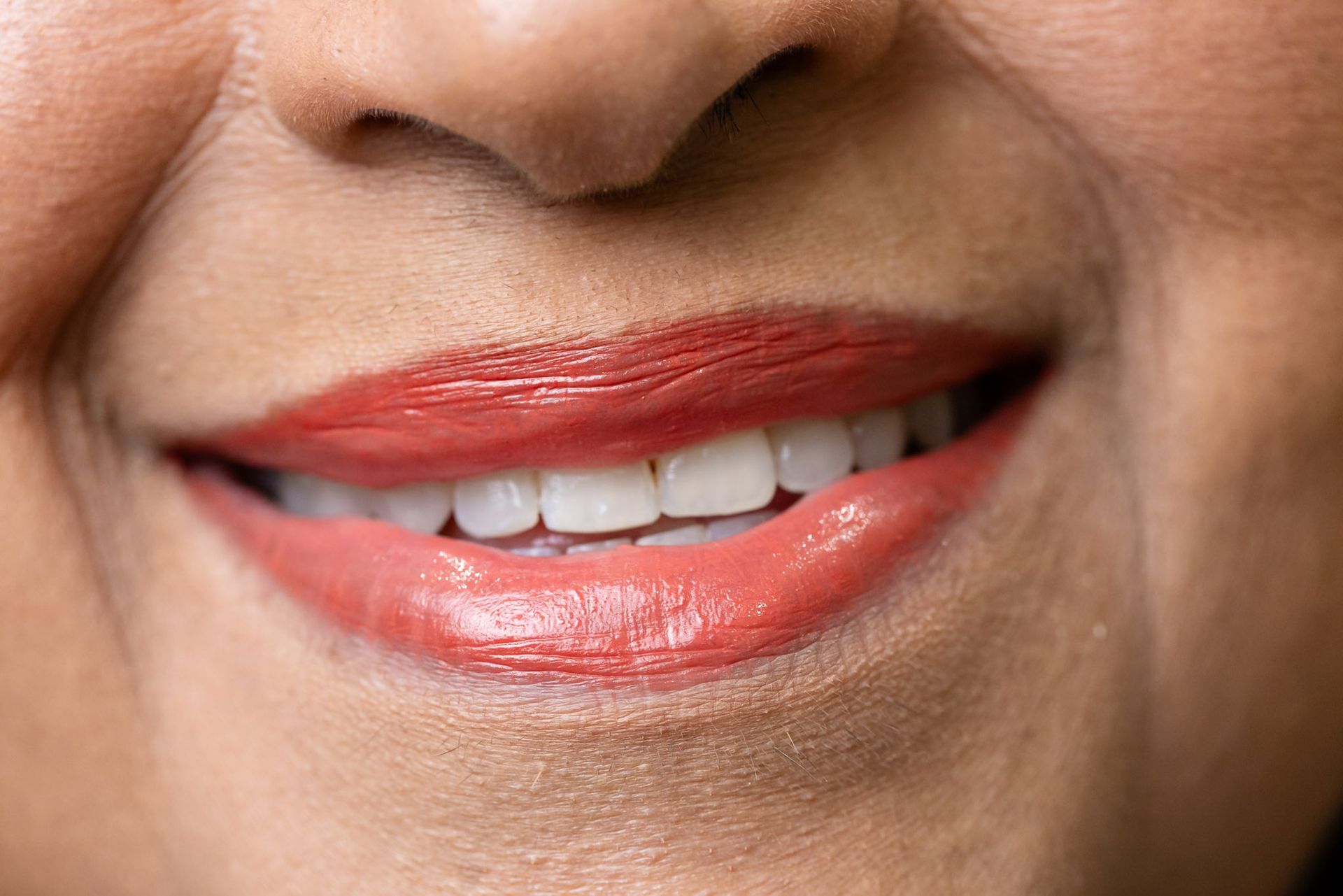 Close-up of a bright, even smile and healthy gumline in Davie, FL