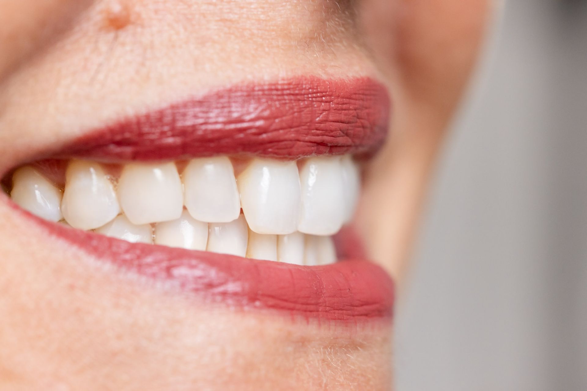 Close-up of a smiling mouth showing white teeth and red lipstick